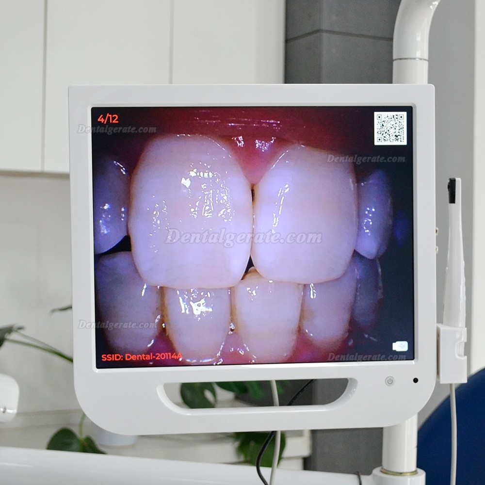 Dental Intraorale Kamera mit 17-Zoll-LCD-Monitor